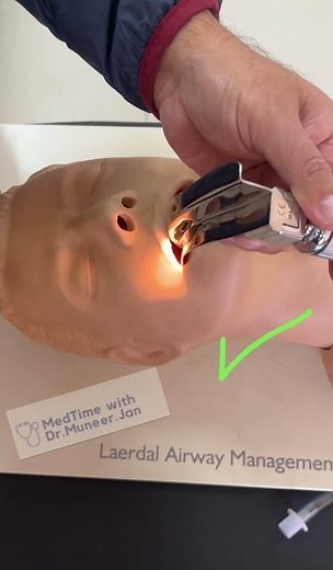 MACINTOSH BLADE INSERTION TECHNIQUE #criticalcaremedicine #emergencymedicine#airwaymanagement