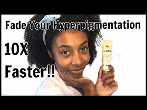 How To REALLY Use Ambi Fade Cream | Fade Hyperpigmentation