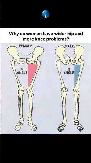 Q-Angle: The subtle difference in knee alignment between males and females. 🦵