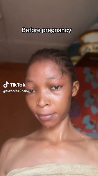 Pregnancy 🤰 Humble Me 🥺😎