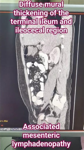 #ctscan #humananatomy #anatomy #ctscan #doctor #medicalimaging