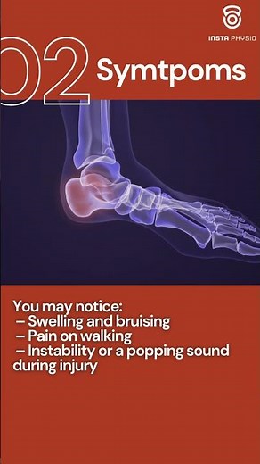 Ankle Ligament Tear: Symptoms & Fast Recovery Tips in 60 Sec!