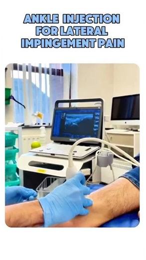 Ankle Pain? Could Be Impingement — Ultrasound guided Injections for Fast Pain Relief