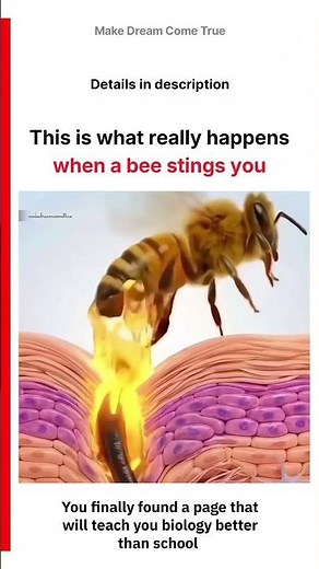 🐝 This is what really happens 🔬 when bee stings you 🩺 | MDCT