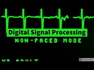 DSP L2 - Frequency domain sampling and reconstruction of Discrete time signal(Part 2)