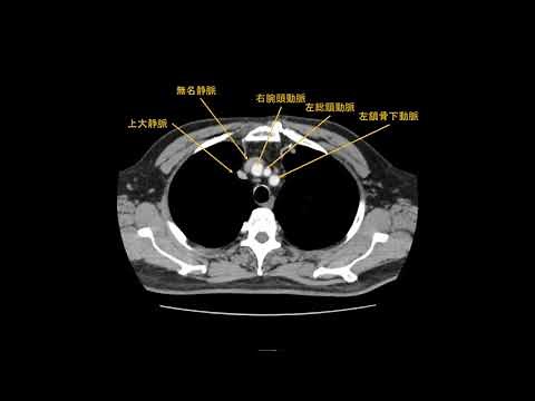 呼吸器外科 E-Learning 第3回 胸部CTの読影