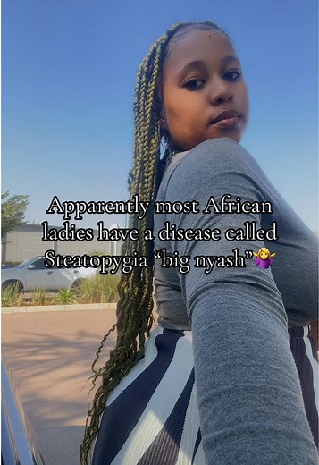 Understanding Steatopygia: A Celebration of African Beauty