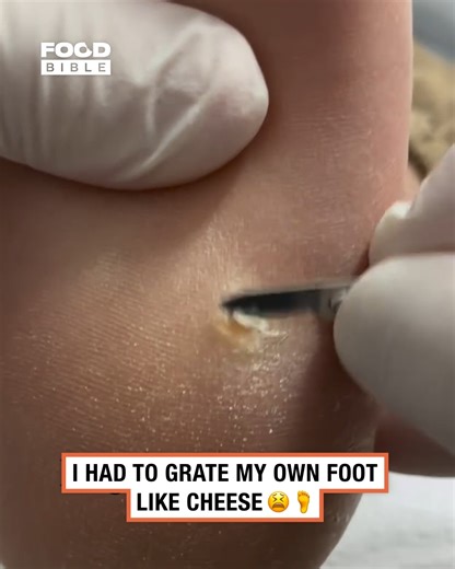 Grating my foot like cheese 😬 | FOODbible