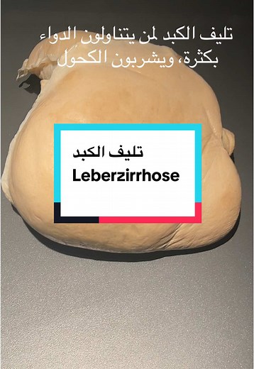 #Ramadan2025 #دكتور غيث عبد#aorticvalve #mitralvalv #tricuspidvalve #pulmonaryhypertension #3danimation #heart #anatomy #education #smartdoctor1 #pharma #تشمع_الكبد #الكبد_الدهني #اكسبلورexplore #اكسبلورالكحول