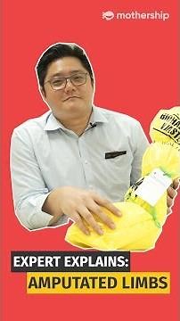 Here's what happens to amputated limbs