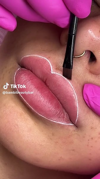 Transforma tus labios con el procedimiento Baby Lips