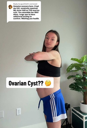 Understanding Ovarian Cysts: Your Experiences Matter