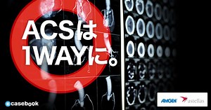 ACSは1WAYに。