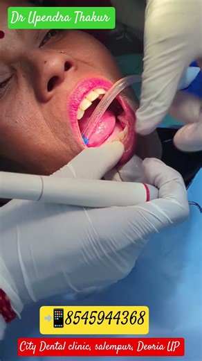Tooth Scaling | Dant Ki Safai |Tooth RCT #citydentalclinicsalempur #dentist #dentalclinic
