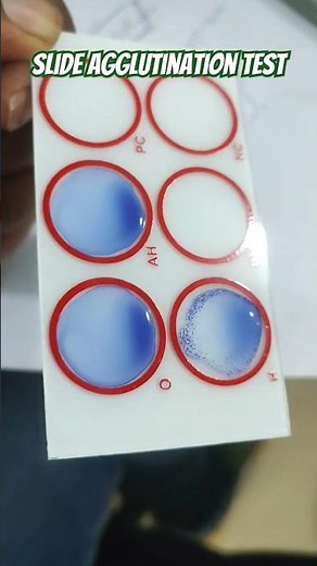 Slide Agglutination test