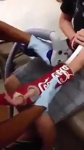 34K views | Getting Cast off.... Look at how tiny his arm got. | Interior Design Ideas | Facebook