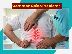 7 Common Spine Issues That Can Happen To Anyone, Know How To Cope Up