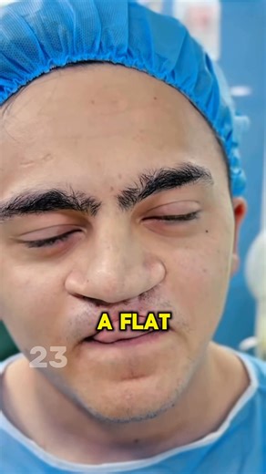 24K views · 96 reactions | Young Man With Flat and Crooked Nose Gets Surgery And You Won’t Believe His Transformation... Results in Comments  | I Believe | Facebook