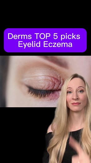 Top Moisturizers for Eyelid Eczema Relief