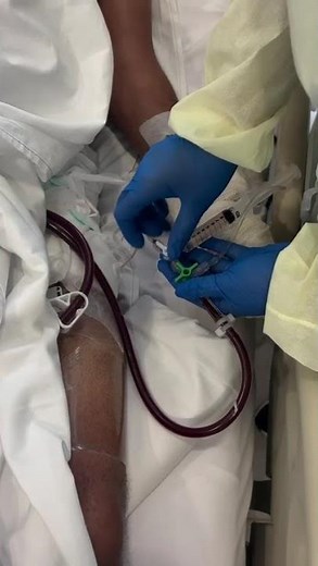 Teste do reperfusor arterial na ECMO-VA