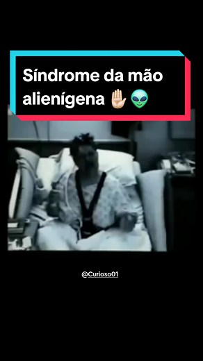 Síndrome da Mão Alienígena: Entenda o Fenômeno