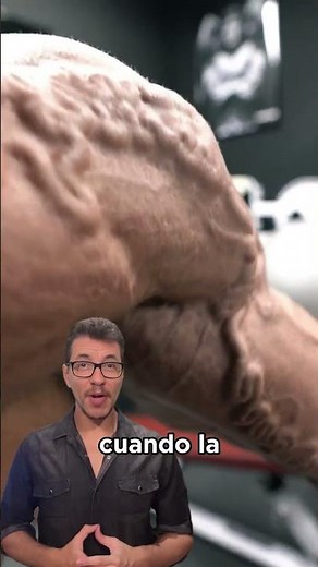 These veins are going to explode 😨