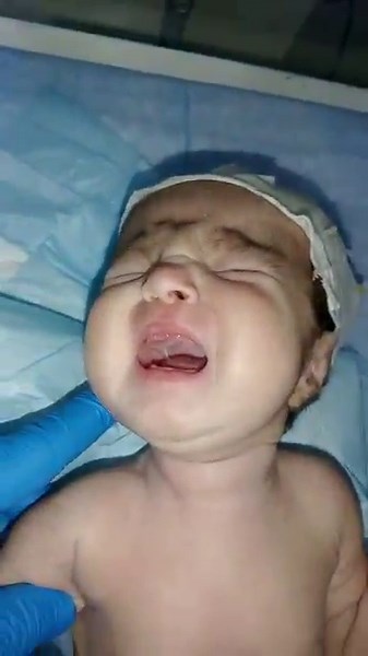👶 Newborn Baby Diagnosis Meningitis | Feeding Tube Procedure | NICU Male Nurse Care