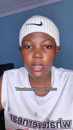 Treatment for pimples