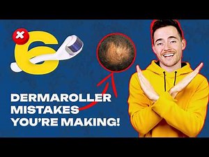 Dermaroller Mistakes - Avoid THESE to regrow MAX hair