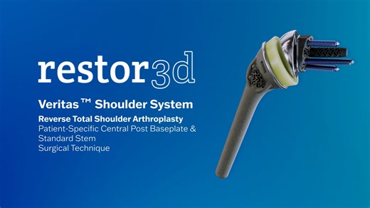 rTSA Surgical Animation