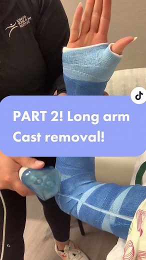 Arm Cast Removal Process | Orthopedics and Medical Procedure