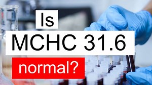 Is MCHC 31.6 normal, high or low? What does Mean corpuscular hemoglobin concentration level 31.6 mean?
