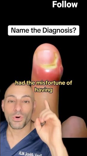 Doctor Explains COMMON Hand infection