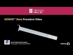 GIOBOR™ Stent Procedure Video - Dr. Kongkam