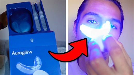 Watch What To Expect With The Auraglow Teeth Whitening Kit on Amazon Live