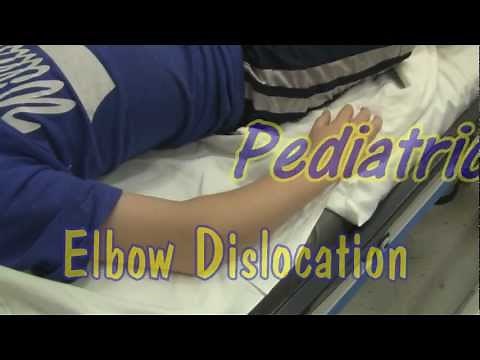 Pediatric Elbow Dislocation