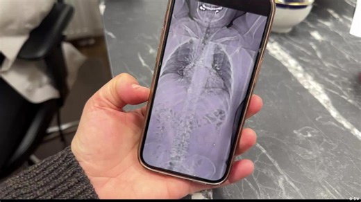 German medical network helps Iran's injured protesters