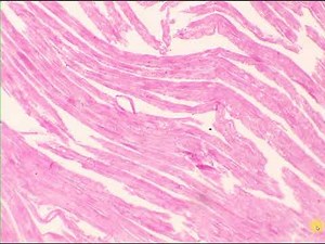 Cardiac muscle, intercalated disc Heart