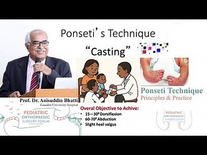 Clubfoot Ponseti Casting Technique | Treatment Step - By - Step | Prof dr. Anis uddin Bhatti