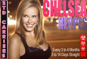 Chelsea Lately's Chelsea Handler's Herpes Simplex