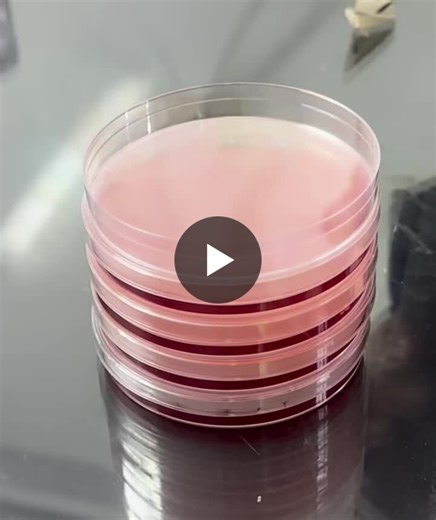 🧫 XLD (Xylose Lysine Deoxycholate) Agar – Preparation Key Points XLD agar is a selective and differential medium used mainly for the isolation of Salmonella and Shigella from stool specimens. 🔬… | aleema shah