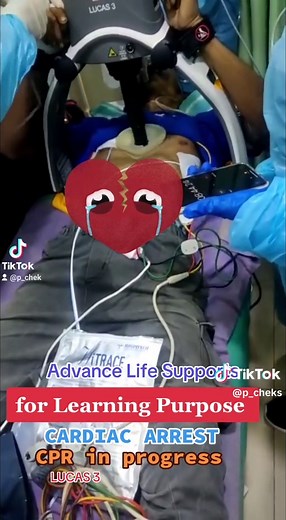 Mechanical CPR Using LUCAS 3 System for Emergencies