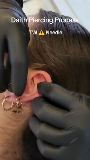 Here's a quick and simple daith piercing with our titanium 10mm clickers. This piercing is also known to get rid of headaches, and about 80% of my clients will confirm that it has helped with headaches. It's important to note that there is nothing anatomically there that explains why it relieves migrains. DM me if you have any questions. I'll be in orange today through Friday. . . . #daithpiercing #daith #migrainepiercing #migrainerelief #earpiercings #piercingsnearme #piercer #piercernearme #or