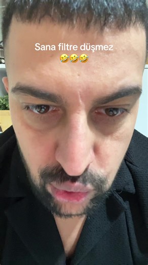 Karagül Filtre Düşmesi Komedisi