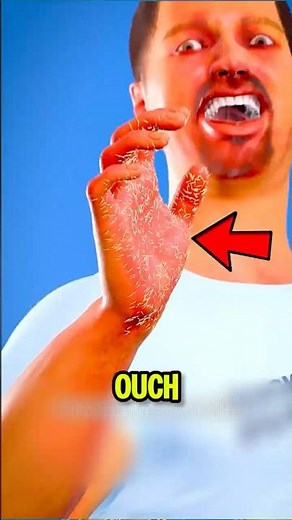 How to Remove Cactus Spines Safely 🌵