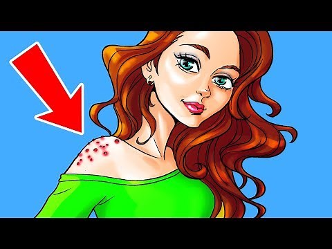 7 Ways to Get Rid of Acne All Over Your Body