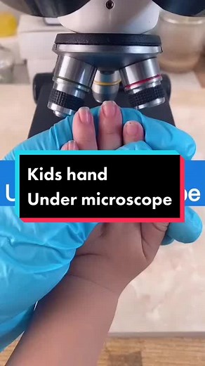 Exploring Adult Nails Under a Microscope | Microscopic Nail Analysis