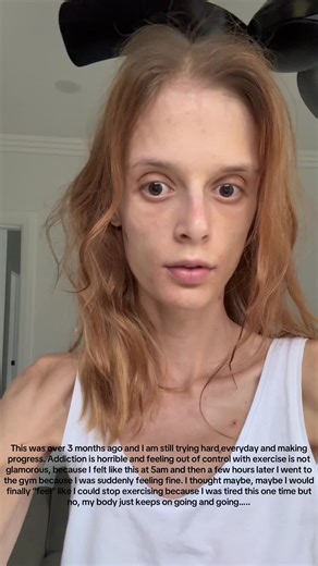 Mental Health Recovery: Overcoming Exercise Addiction | Real Journey