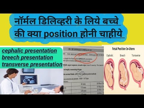 Cephalic presentation क्या नॉर्मल बेबी डिलिव्हरी के पोसिशन चाहीये#baby position#normaldelivary