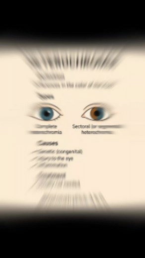 What is Heterochromia :- Heterochromia is a condition where a person (or animal) has differences in the color of the irises (the colored part of the eyes) or within the same iris. In simple terms, it’s when one eye is a different color than the other, or when parts of one eye are a different color than the rest of that same eye. Types of Heterochromia :- 1. Complete heterochromia – Each eye is a completely different color (e.g., one blue, one brown). 2. Sectoral (or segmental) heterochromia – A 